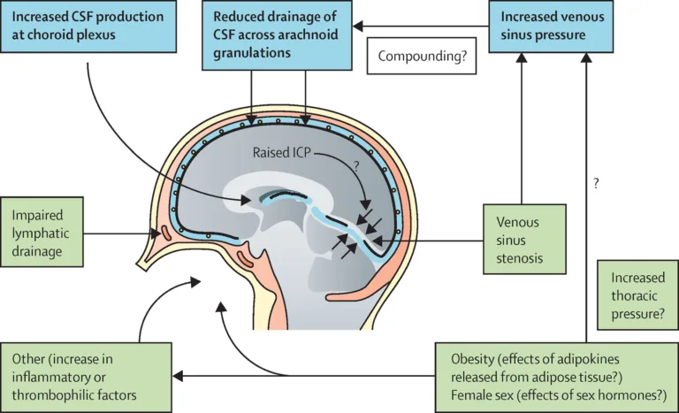 intracranial hypertension